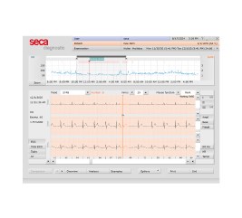 Screenshot of the seca diagnostic software showing ECG data and heart rate trends over time, with a detailed waveform analysis and measurement options.