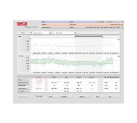 Screenshot of the seca diagnostic software displaying ambulatory blood pressure monitoring (ABPM) results with graphs for heart rate and blood pressure trends over time, along with detailed numerical data.