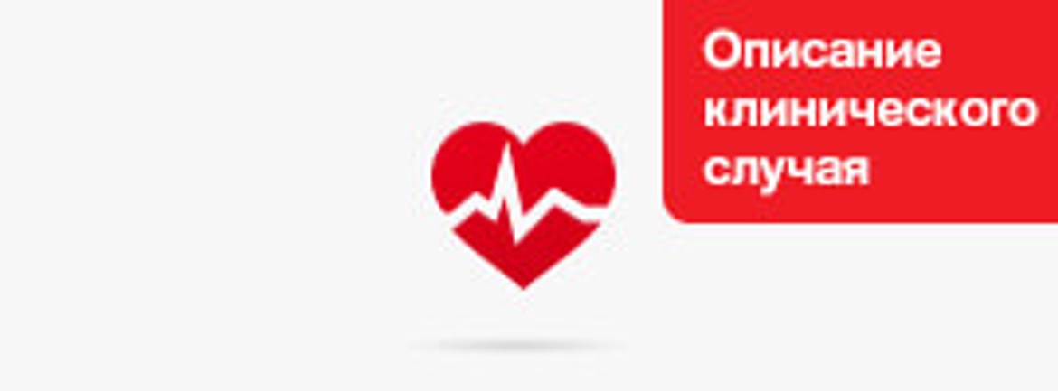 Описание клинического случая: Сердечная недостаточность