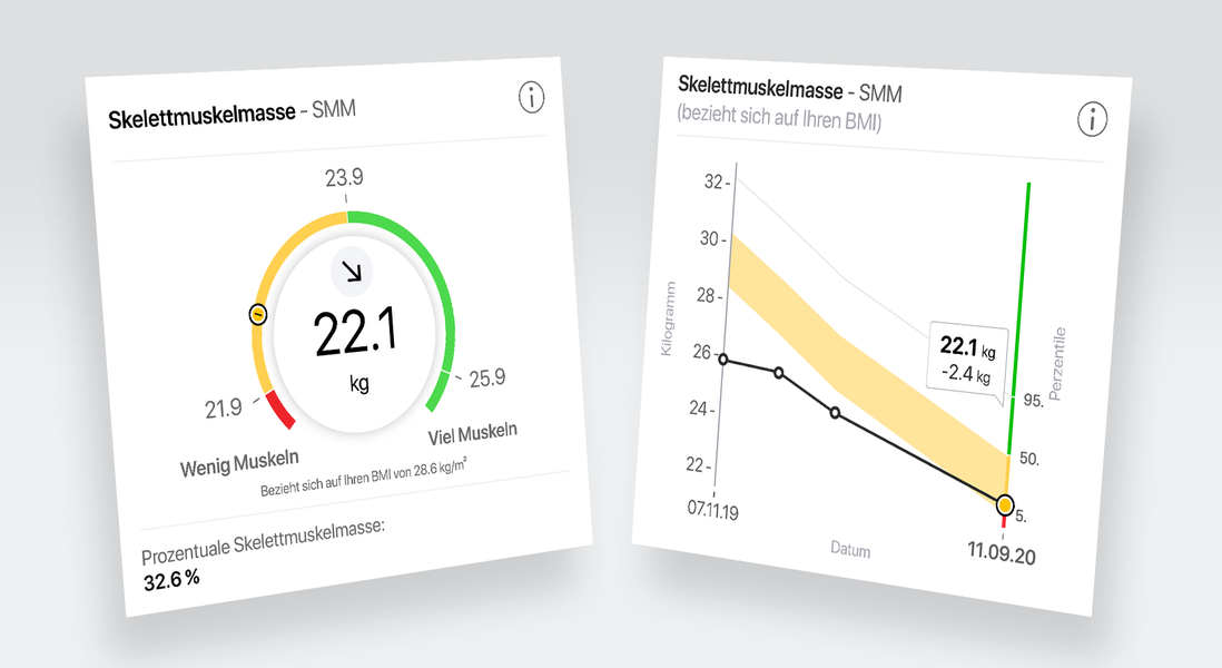 Die gesamte Skelettmuskelmasse des Körpers.