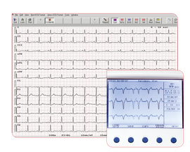 seca Thrombolysis Upgrade